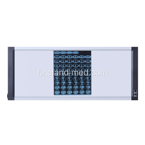 حرفه ای پزشکی Led Film Viewer X-Ray View Box